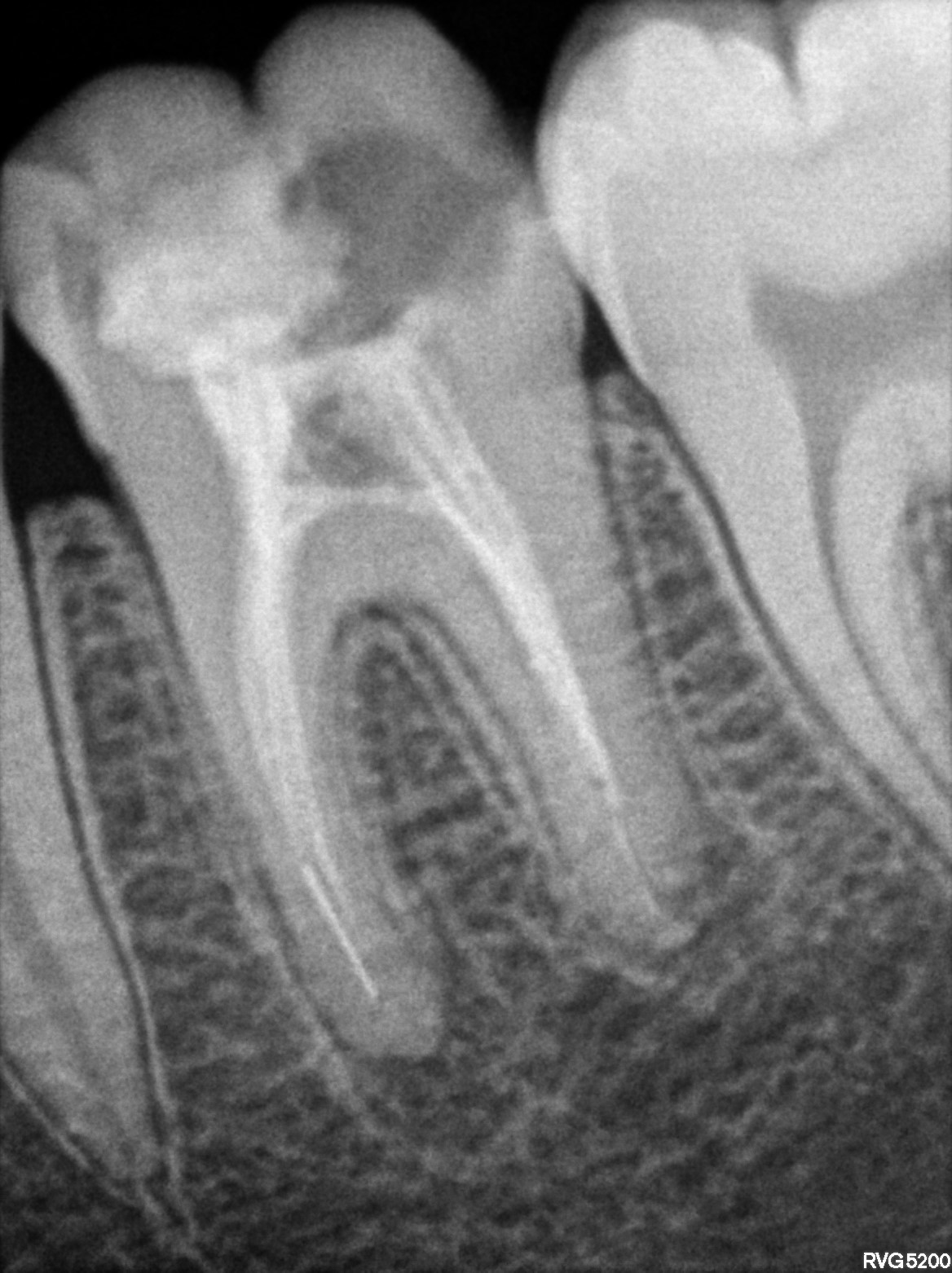 Dental X-ray